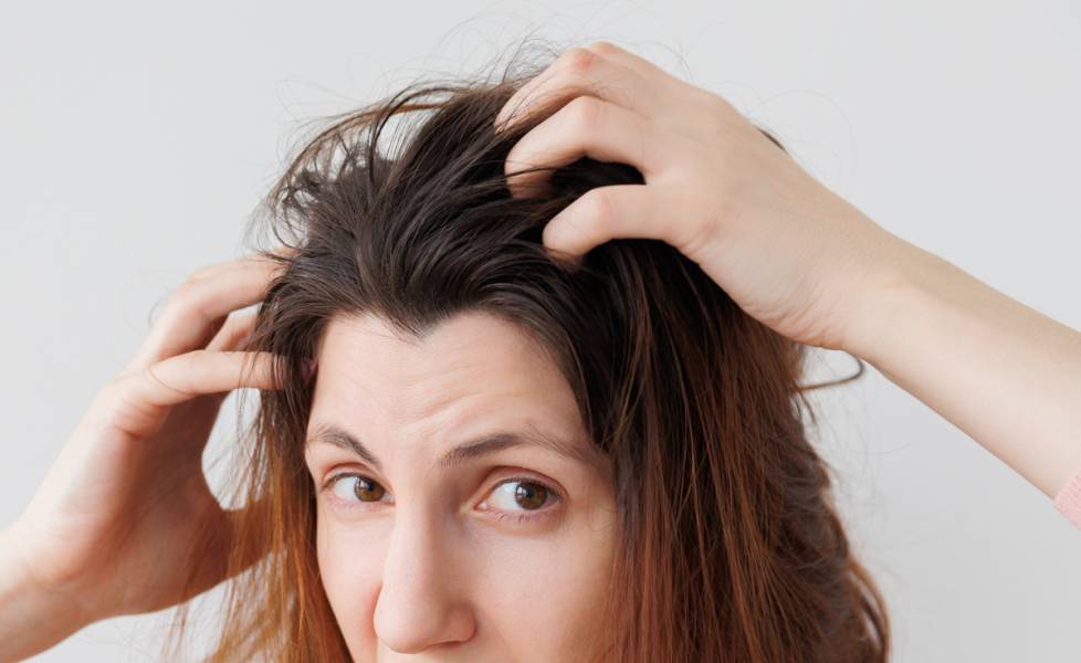 Does Dandruff Cause Hair Loss? A Dermatologist Answers Your Most Common Questions